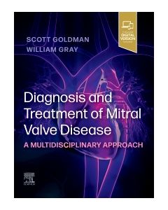 Diagnosis and Treatment of Mitral Valve Disease