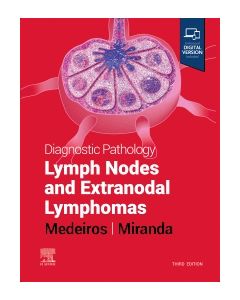 Diagnostic Pathology: Lymph Nodes and Extranodal Lymphomas