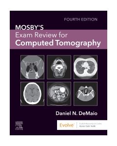 Mosby's Exam Review for Computed Tomography