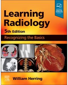 Learning Radiology