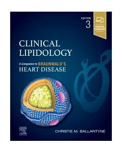 Clinical Lipidology