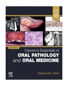 Cawson's Essentials of Oral Pathology and Oral Medicine