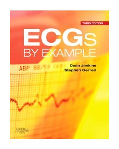 ECGs by Example