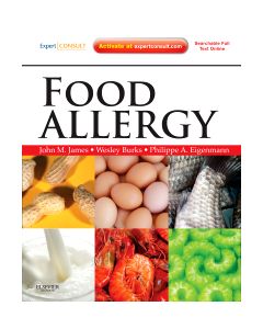 Food Allergy